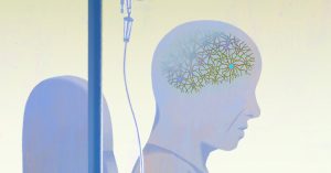 Leqembi ve Alzheimer: Yeni İlaç, Tedavi ve Faydaları Hakkında Bilmeniz Gerekenler